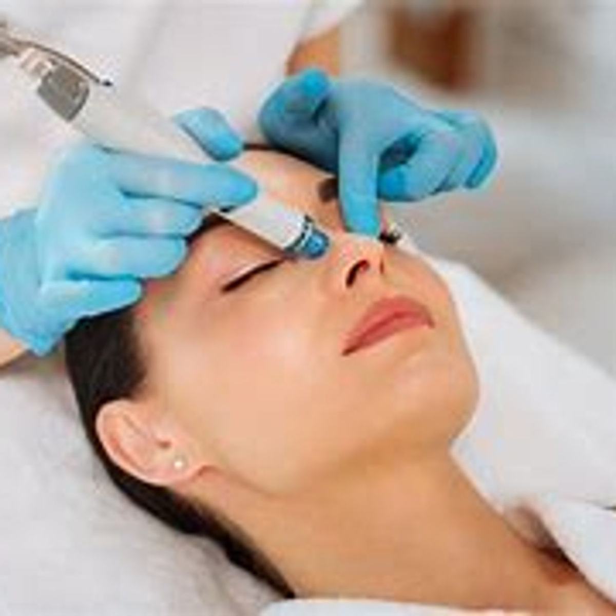 Hydrafacial à Rouen : le soin visage incontournable pour une peau éclatante