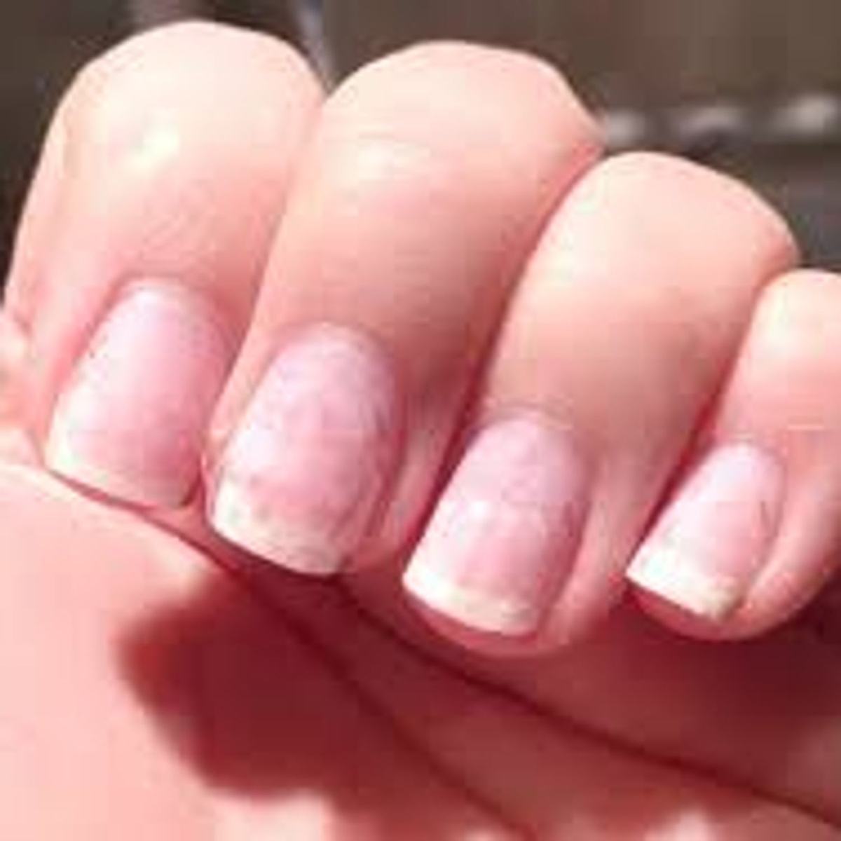 ❗️Pourquoi il ne faut jamais arracher le gel sur l’ongle naturel