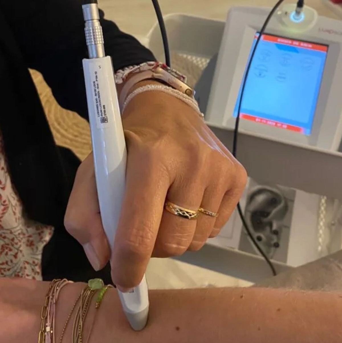 L ARRET DE TABAC ET LA LUXOPUNCTURE