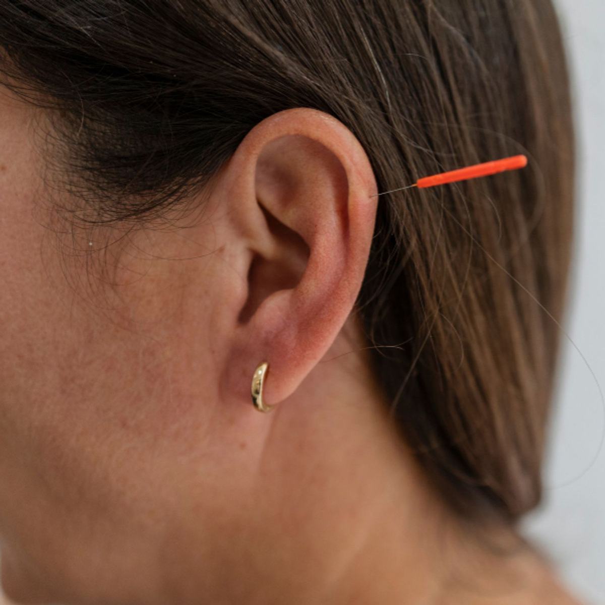 Arrêter de fumer avec l’acupuncture de l’oreille et la stimulation auriculaire au laser à Strasbourg