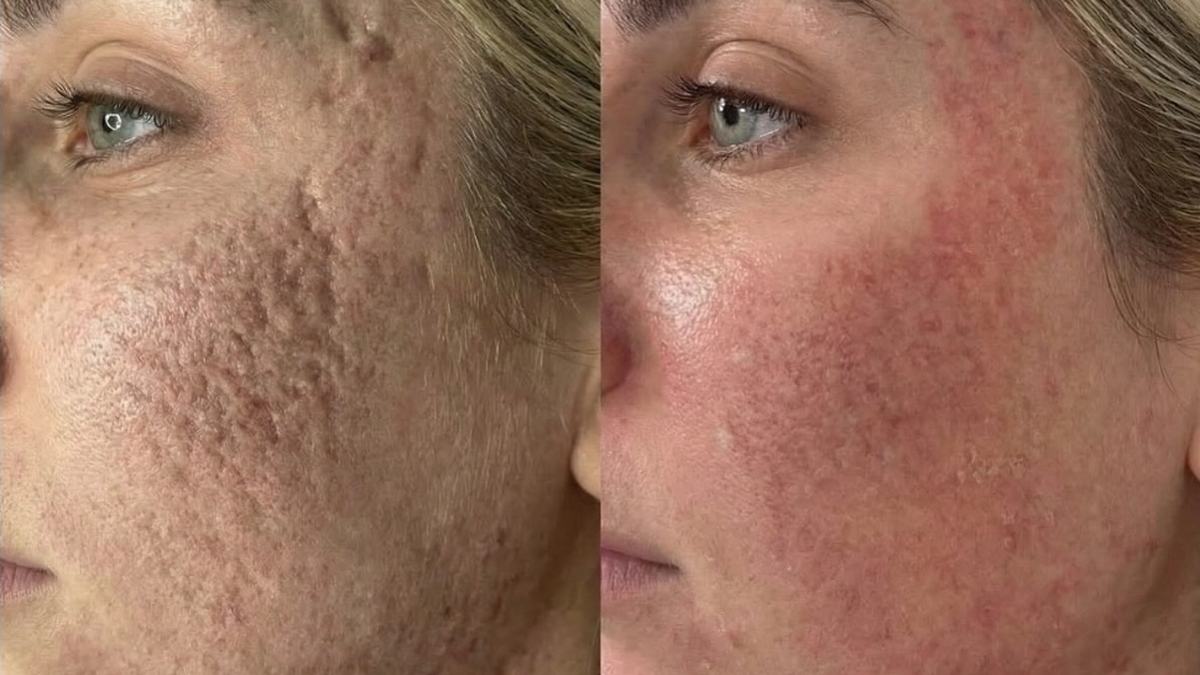 Laila Beauty Experte Bois-Guillaume