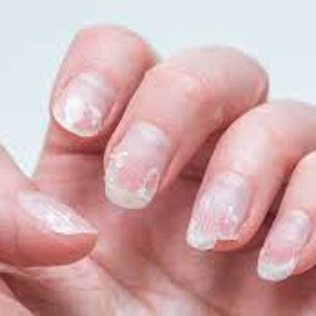 Ongles mous : causes, solutions et conseils d'une prothésiste ongulaire
